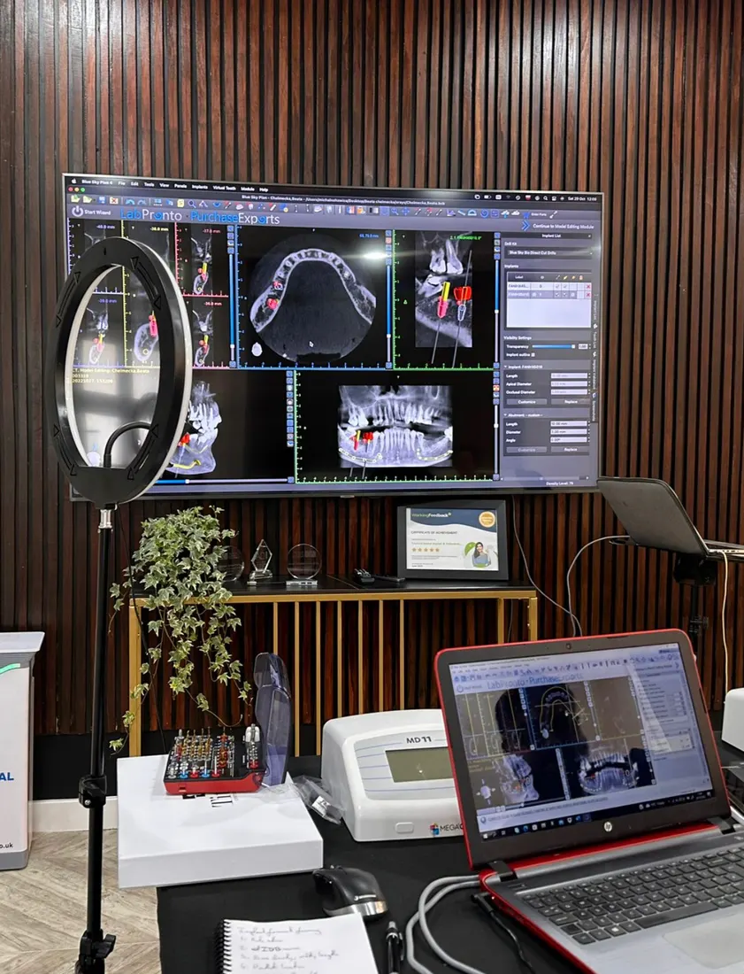 Digital implant planning on screen at a BCDIS clinic